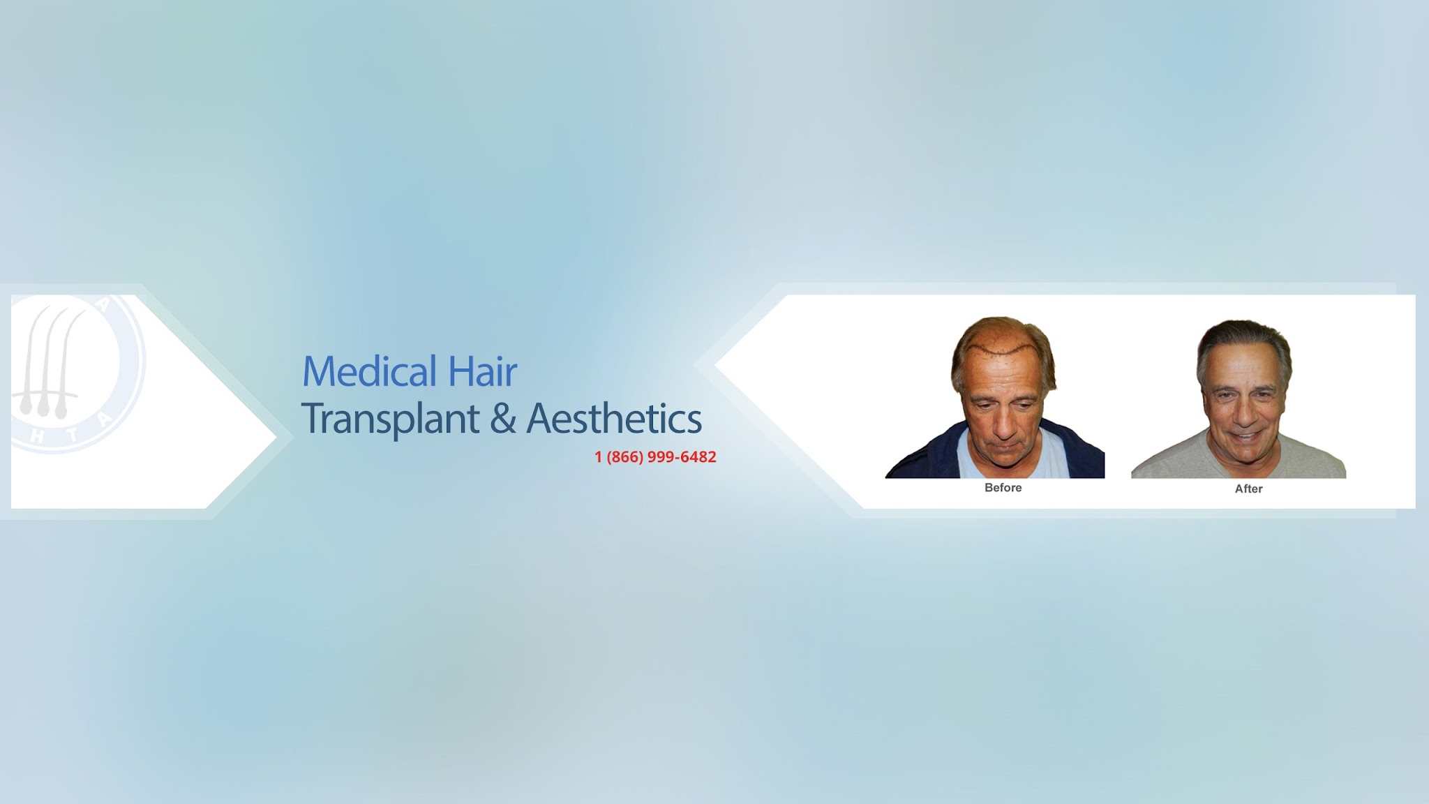 Medical Hair Transplants & Aesthetics YouTube banner