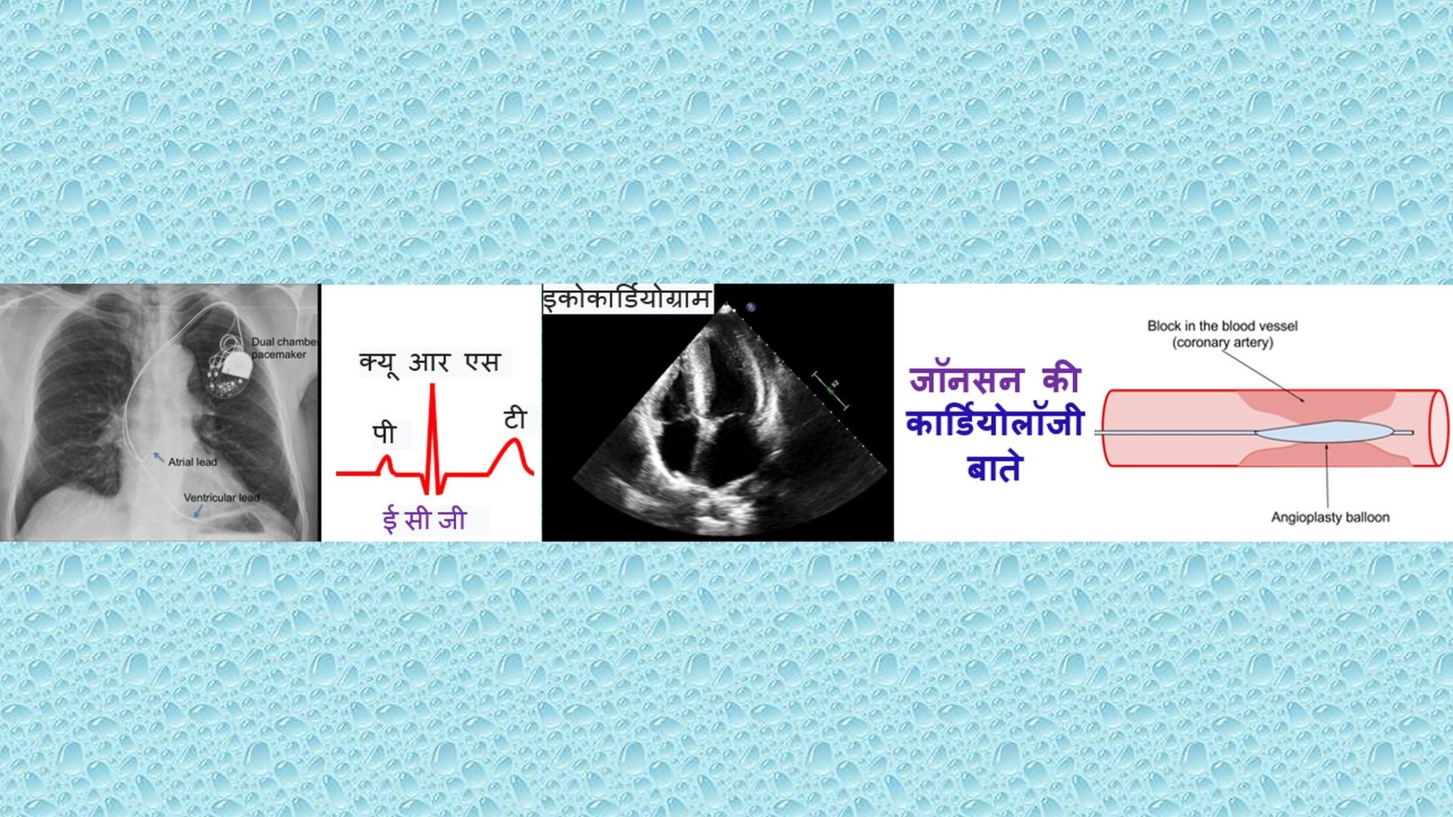जॉन्सनस कार्डियोलॉजी हिंदी YouTube banner