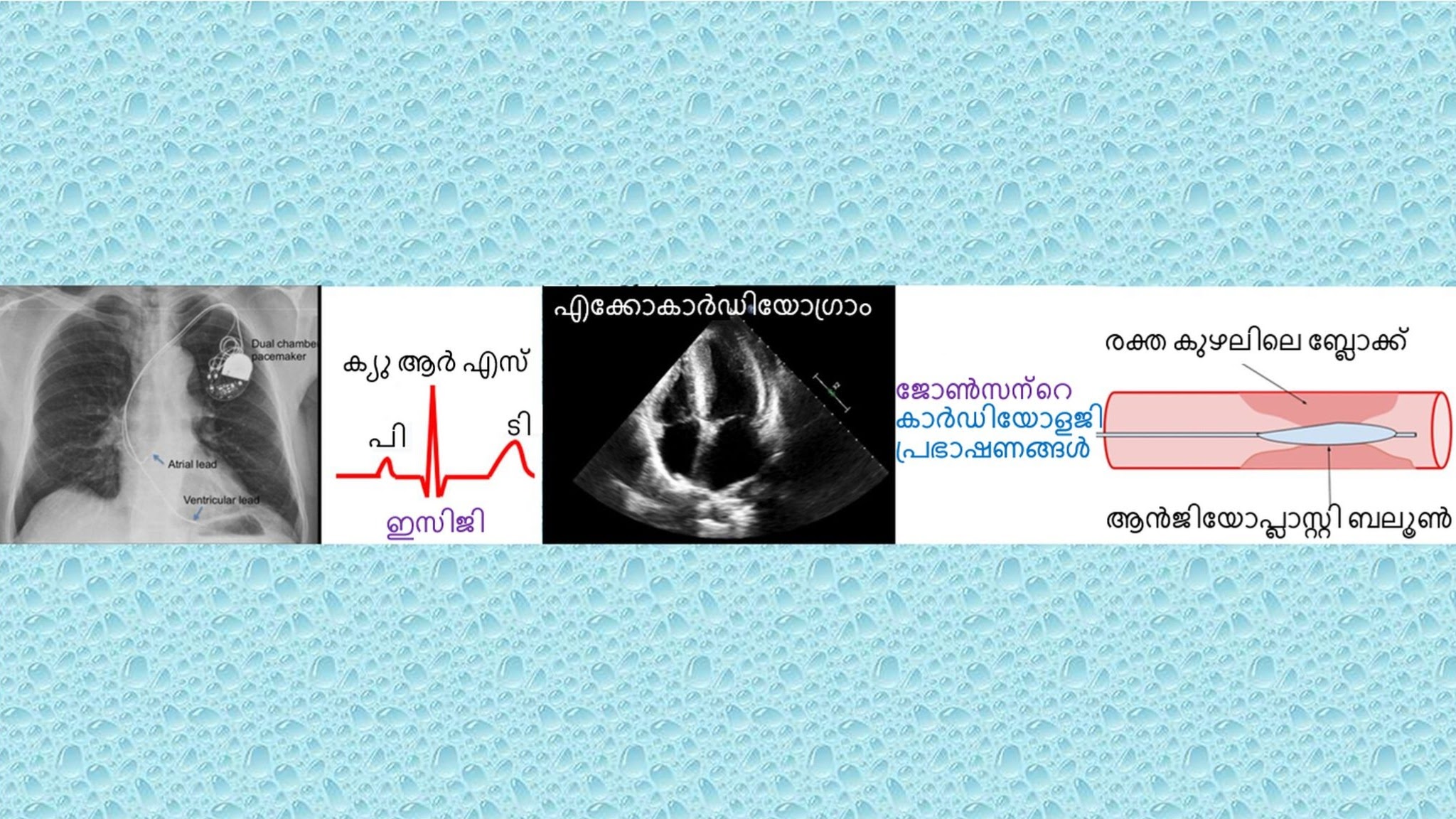 ജോൺസൺസ് കാർഡിയോളജി മലയാളം YouTube banner