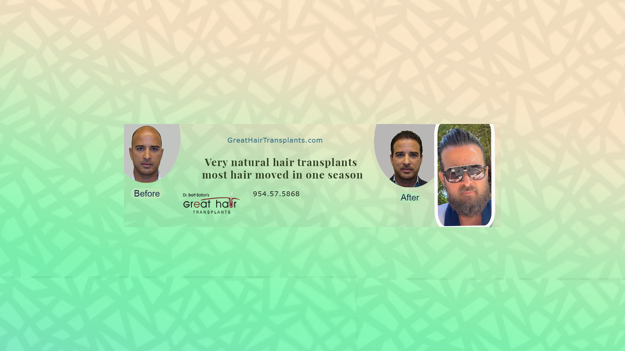 Great Hair Transplants YouTube banner