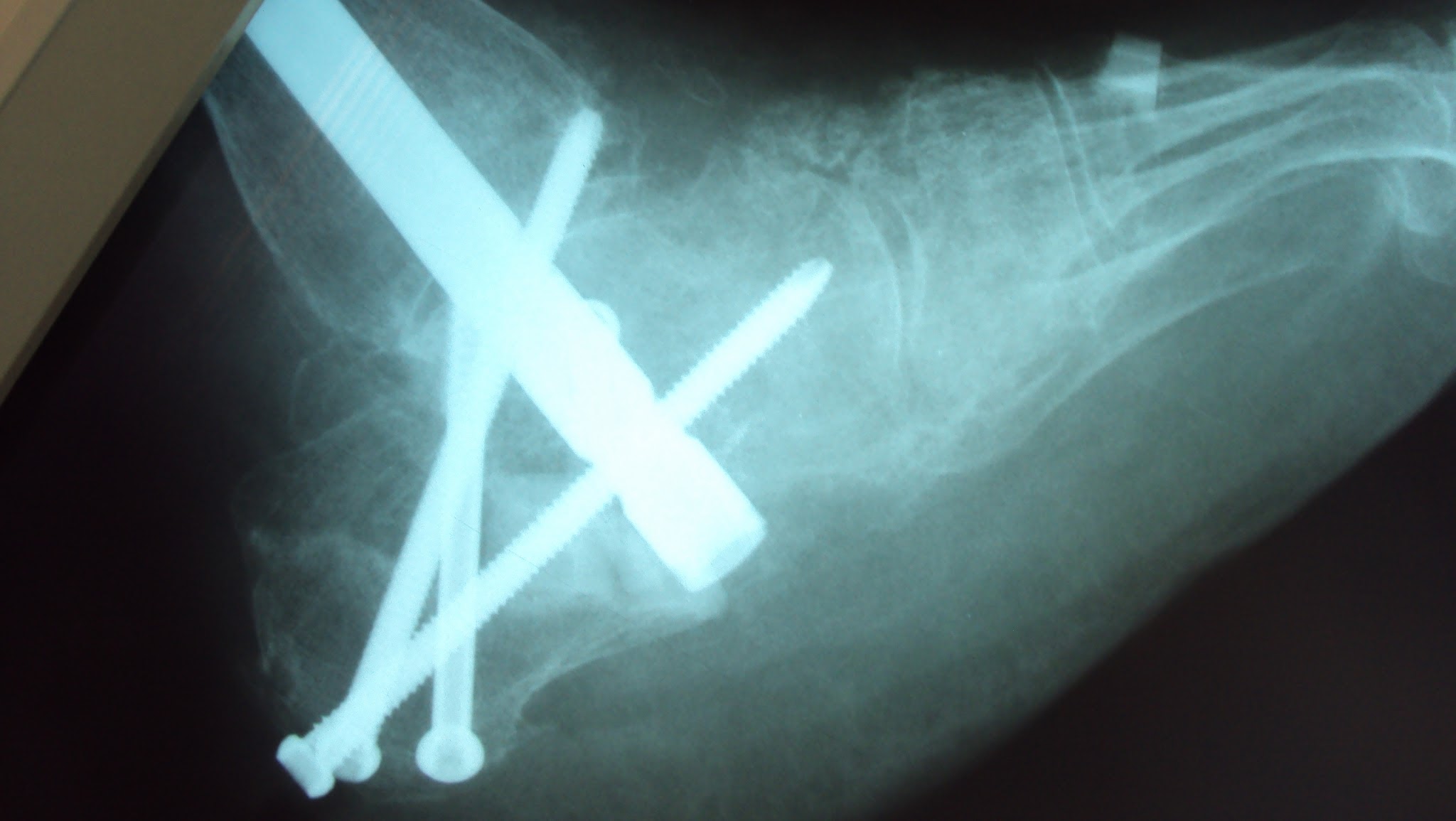 Orthopedic Board Abdelgawad (Pass your board) YouTube banner
