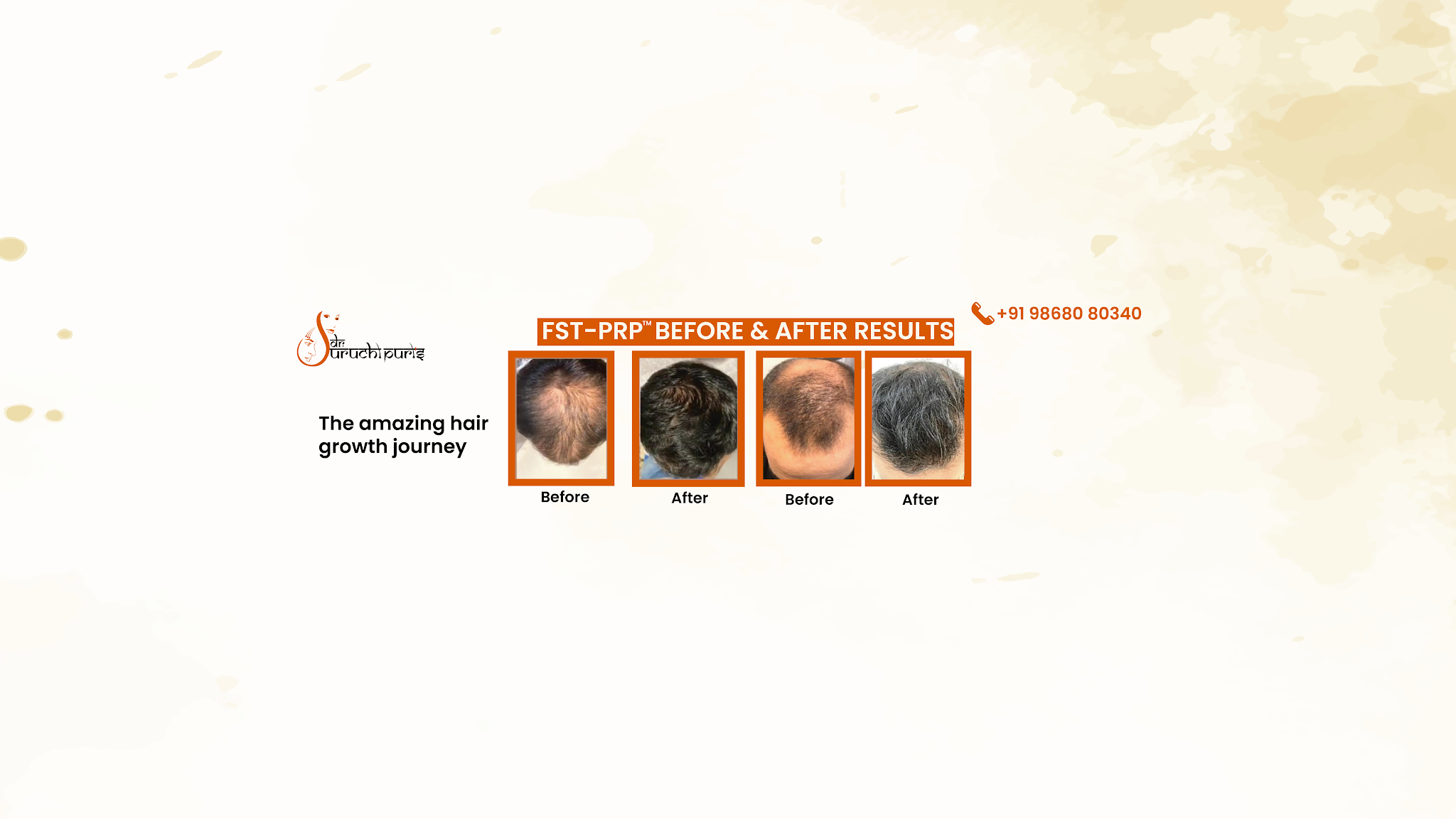 Dr Suruchi Puri - Skin Specialist in Delhi YouTube banner