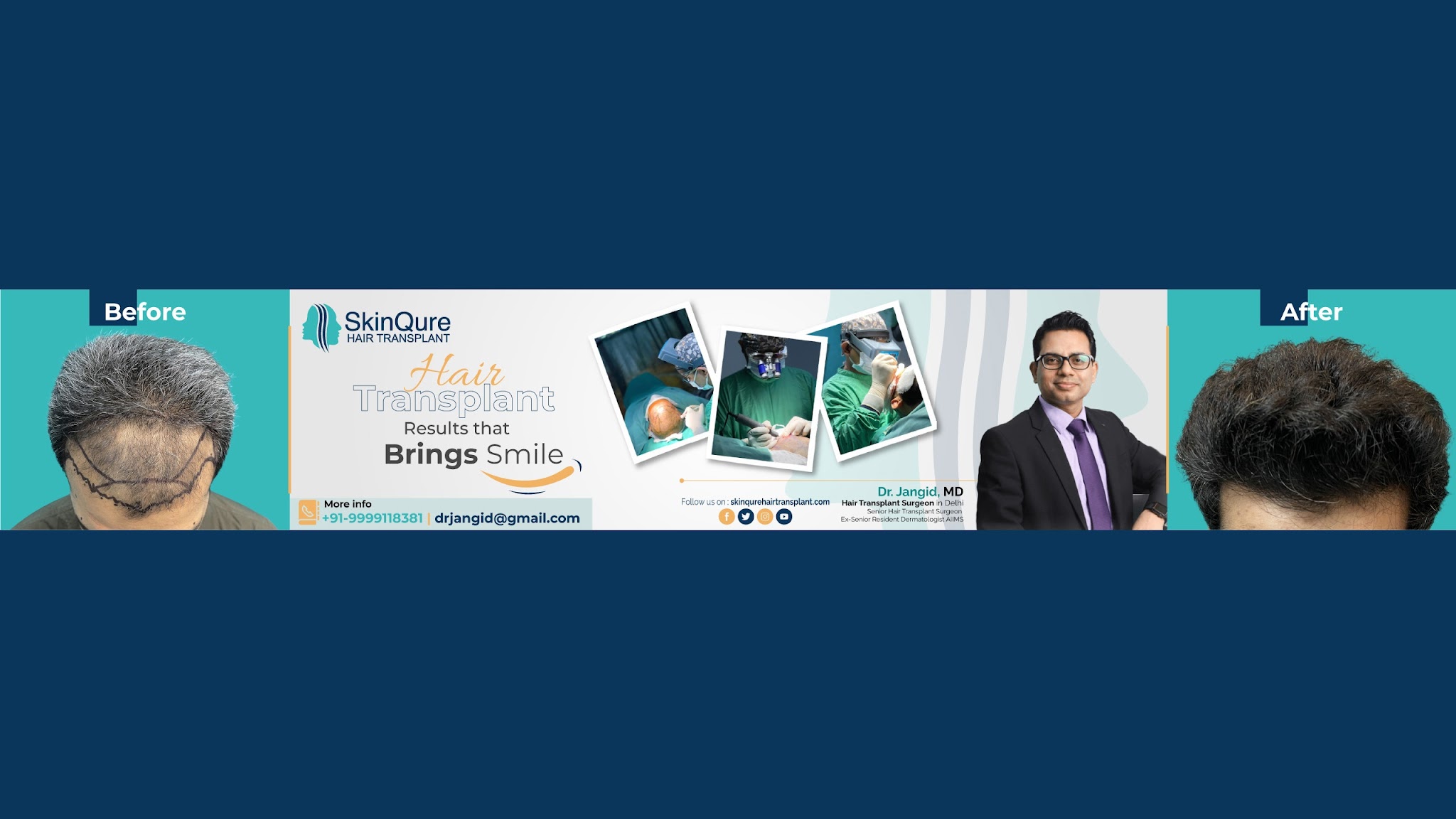 Hair Transplant by Dr. Jangid YouTube banner