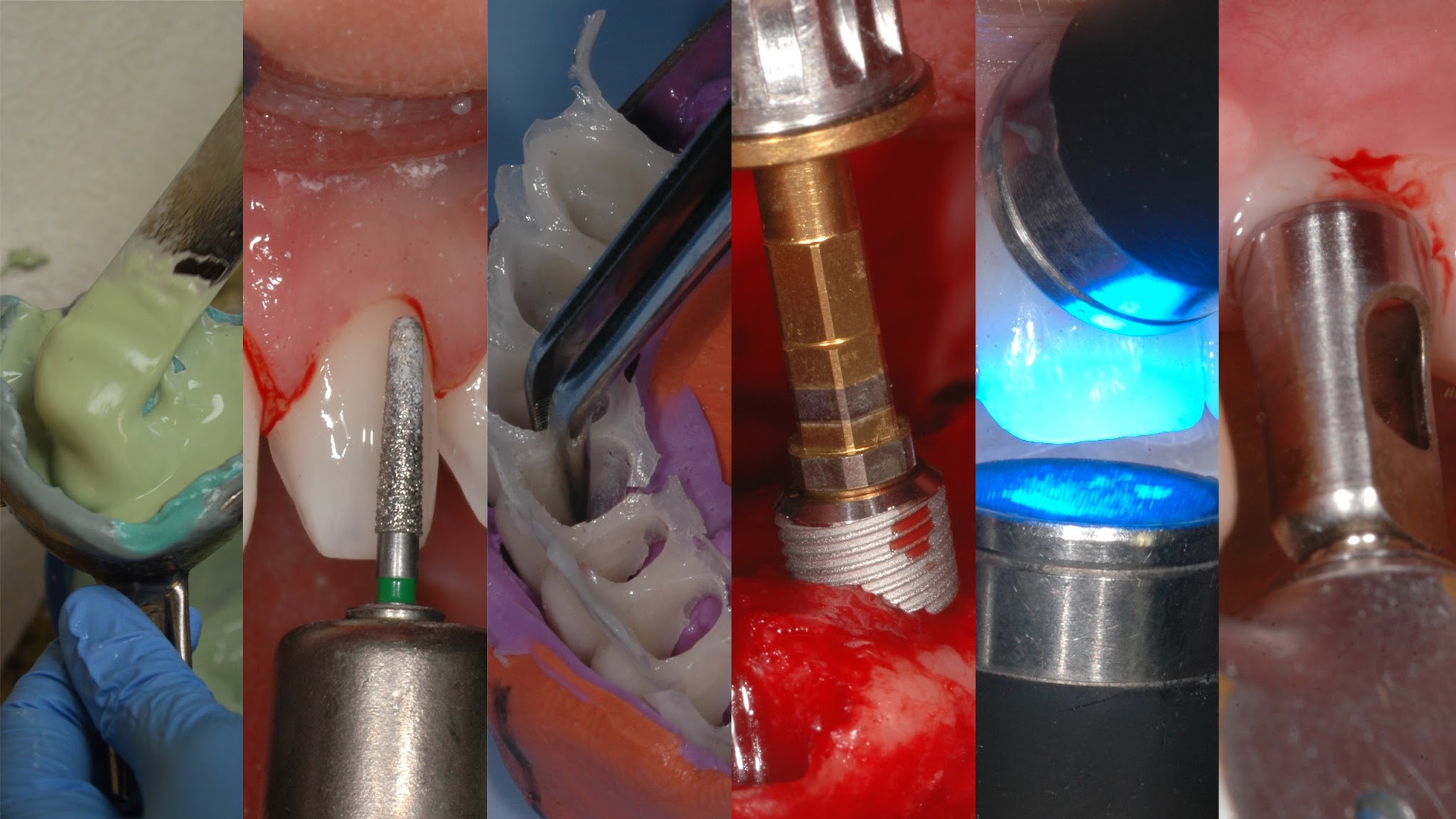 Dental Minute with Steven T. Cutbirth, DDS YouTube banner